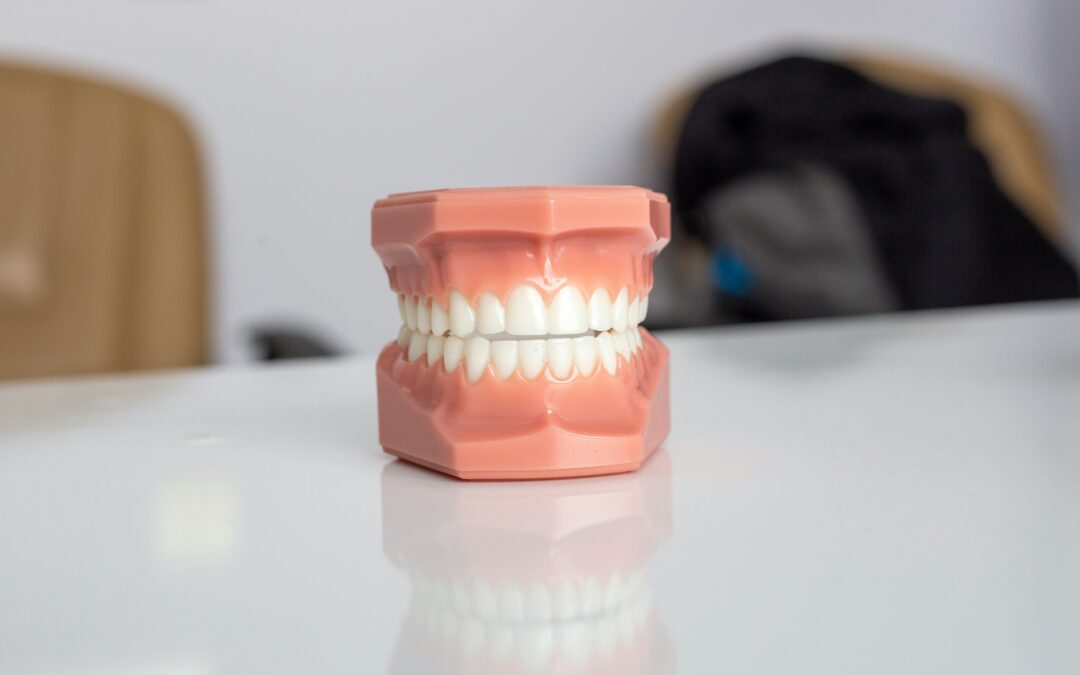 The Benefits Of Annual Laser Teeth Whitening Sessions